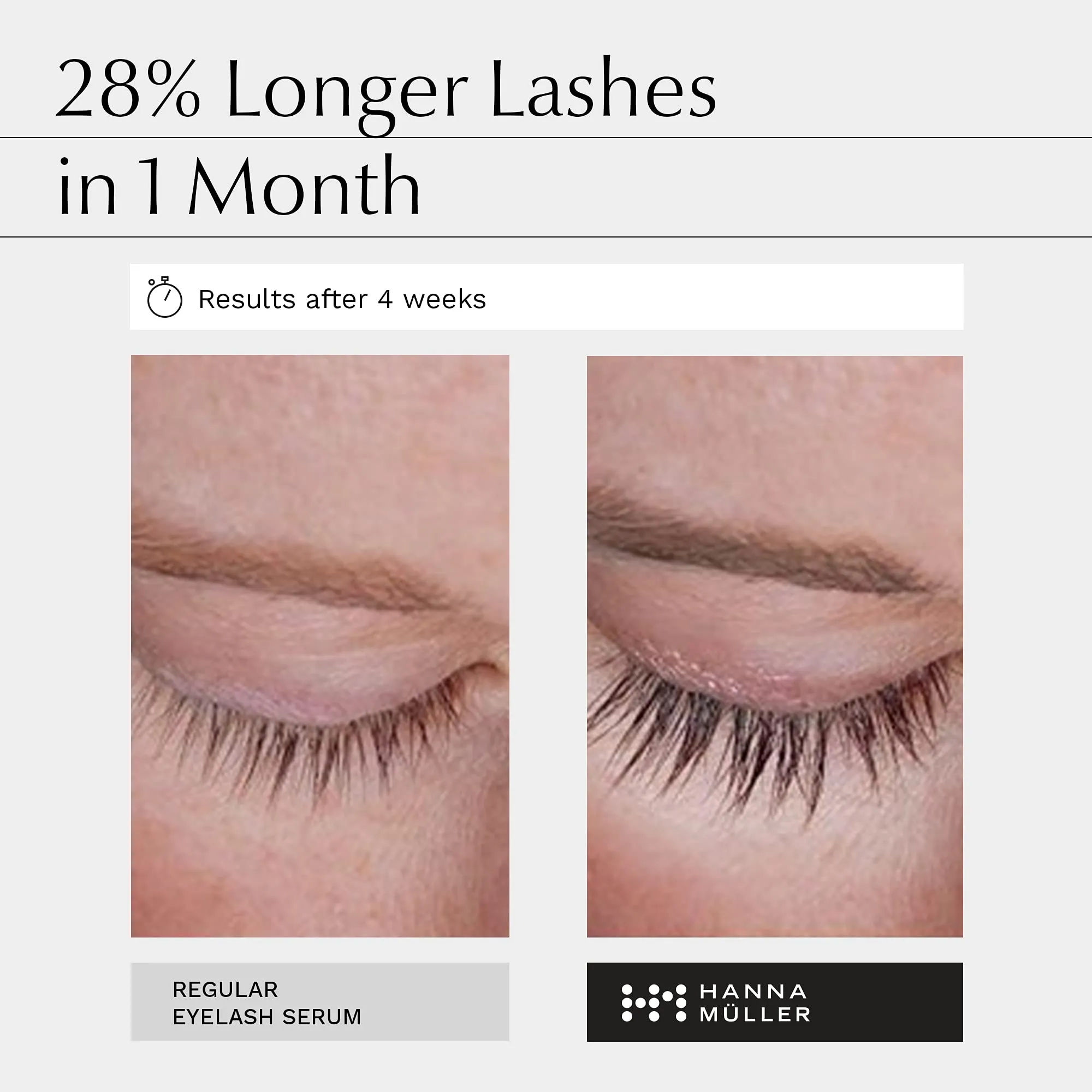 Advanced Eyelash Serum - 3X MORE EFFECTIVE with BIOACTIVE PEPTIDES and PATENTED TETRAOYL™ - Lengthens, Thickens, Strengthens - 2X MORE CONDITIONING - 68% More Volume